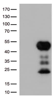 CD32A Antibody (clone UMAB60)