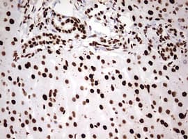 Monoclonal Mouse anti-Human HNRPM / HNRNPM Antibody (clone OTI3F3, aa1-261, IHC, WB)