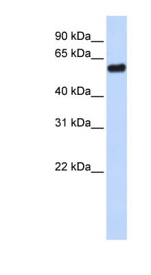 TP53 / p53 Antibody (N-Terminus)