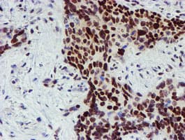 SNAI2 / SLUG Antibody (clone OTI1A6)