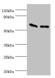 ATP5B / ATP Synthase Beta Antibody (aa230-529)