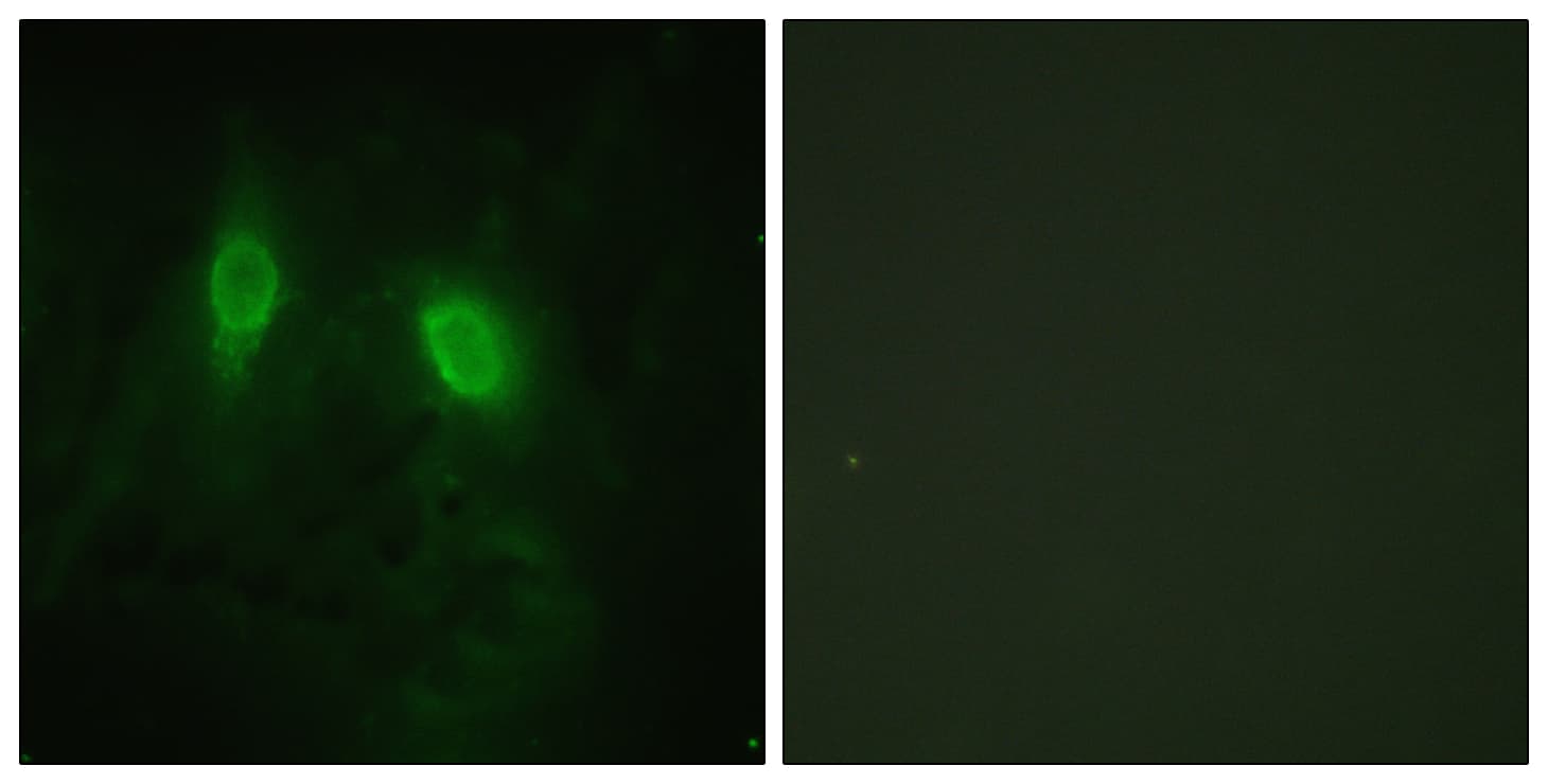 IHC-plus™ IKBKG / NEMO / IKK Gamma Antibody (aa51-100)