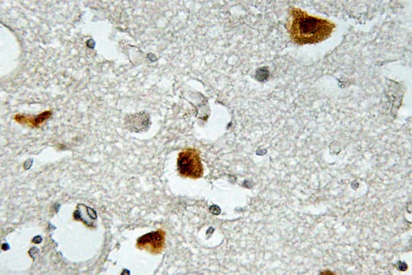 IRS1 Antibody (phospho-Ser636)
