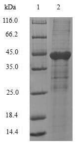 Human CD66a / CEACAM1 Protein (Recombinant)