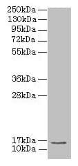 Polyclonal Rabbit anti-Human MRPL51 Antibody (IHC, WB)