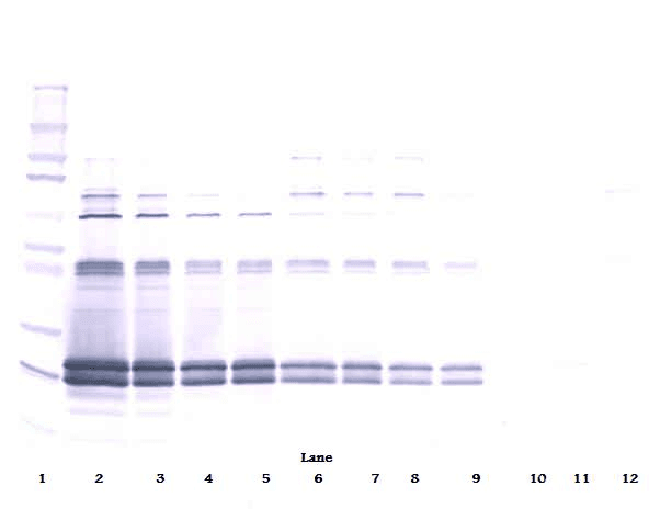 CTF1 / Cardiotrophin-1 Antibody (Biotin)