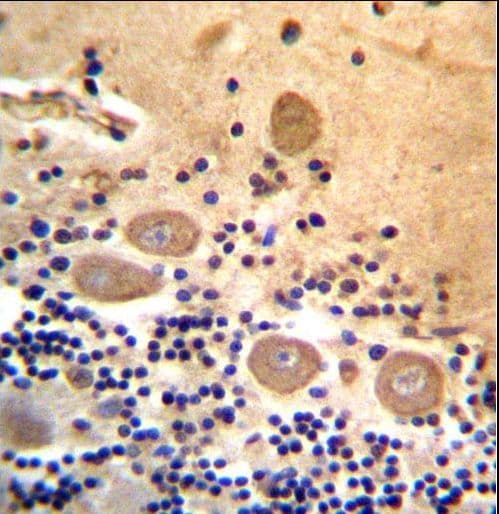RSPH14 / RTDR1 Antibody (aa17-45)