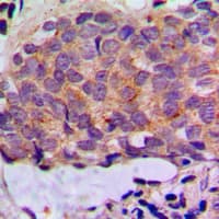 KRT8 / CK8 / Cytokeratin 8 Antibody (C-Terminus)