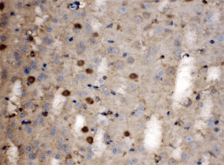 Polyclonal Rabbit anti-Human LDHB / Lactate Dehydrogenase B Antibody (IHC, WB)