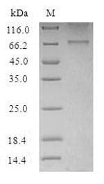 Human HTR2B / 5-HT2B Receptor Protein (Recombinant 6His-SUMO, N-terminus)