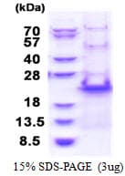 Human RPS20 / Ribosomal Protein S20 (Recombinant His)