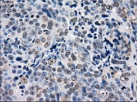 GBE1 Antibody (clone OTI3C8, Carrier-free)