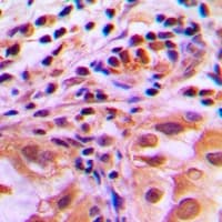 FOXO1 / FKHR Antibody (phospho-Ser256)