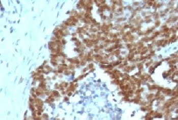 NCL / Nucleolin Antibody (clone NCL/902, Ready-to-Use)
