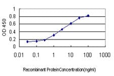 IHC-plus™ BUB1B / BubR1 Antibody (clone 2G5)