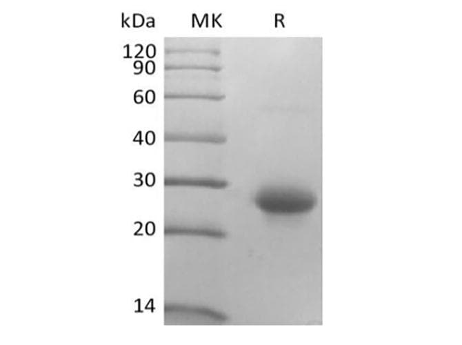 Mouse CD27L / CD70 Protein (Recombinant 10His, N-terminus)