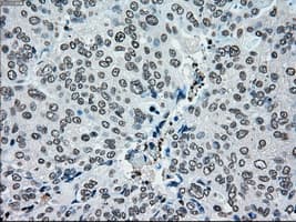 Monoclonal Mouse anti-Human PMEL / SILV / gp100 Antibody (clone OTI10E5, IHC, IF, WB)