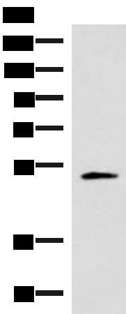 IRX1 Antibody