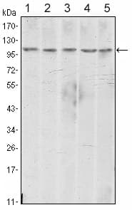 PathPlus™ Monoclonal Mouse anti-Human CDH2 / N Cadherin Antibody (clone 5D5, IHC, IF, WB)