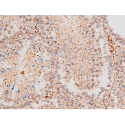 MAPK8 / JNK1 Antibody (phospho-Thr183,pTyr185)