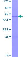 Human SSX4 Protein (Recombinant GST)