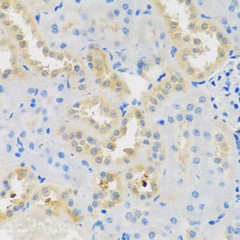 DNAL1 Antibody