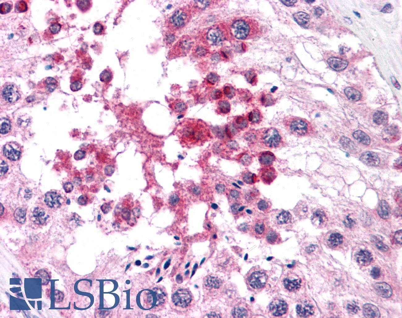 IHC-plus™ DNAL1 Antibody