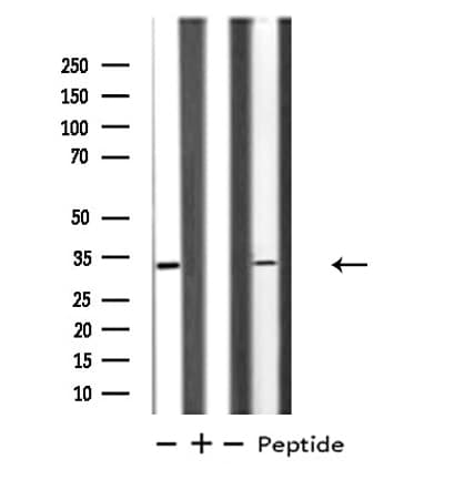 BTLA / CD272 Antibody