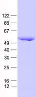 Human KRT16 / CK16 / Cytokeratin 16 Protein (Recombinant His, N-Terminal)