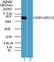 LRRC32 Antibody (aa250-300)