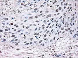 BRAF / B-Raf Antibody (clone OTI1G8)