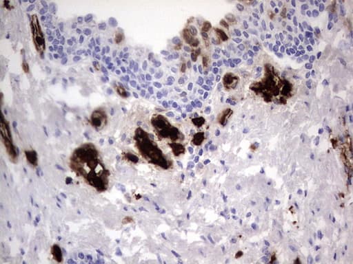 S100A9 / MRP14 Antibody (clone OTI7B1)