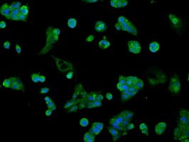 AKR1A1 Antibody (clone OTI6E3)