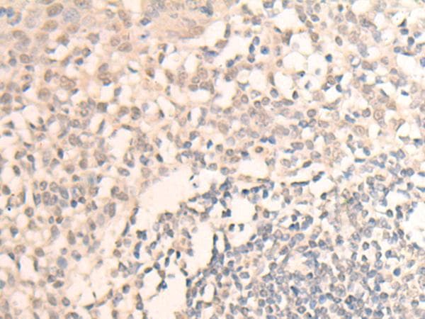 MLLT6 Antibody
