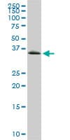 IHC-plus™ GYG1 / Glycogenin Antibody (clone 3B5)