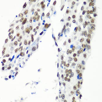Polyclonal Rabbit anti-Human HTATSF1 / TAT-SF1 Antibody (IHC, WB)