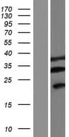 FAM220A / C7orf70 Protein (Over-Expression Lysate Myc-DDK (Flag))
