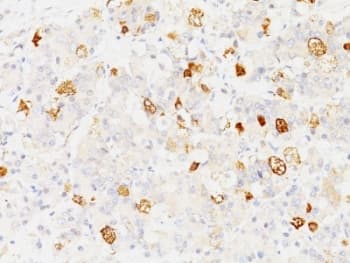 FSHB / FSH Beta Antibody (clone SPM107)