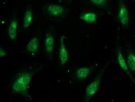 Monoclonal Mouse anti-Human FGF21 Antibody (clone OTI4B2, aa29-209, IF, WB)