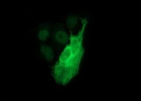 TH / Tyrosine Hydroxylase Antibody (clone OTI1A10, Carrier-free)