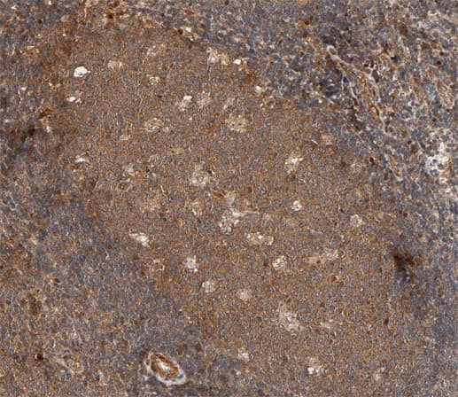 Polyclonal Rabbit anti-Human IL2RB / CD122 Antibody (IHC, IF, WB)