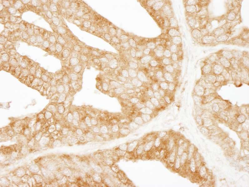 EPS15 Antibody (aa575-625)