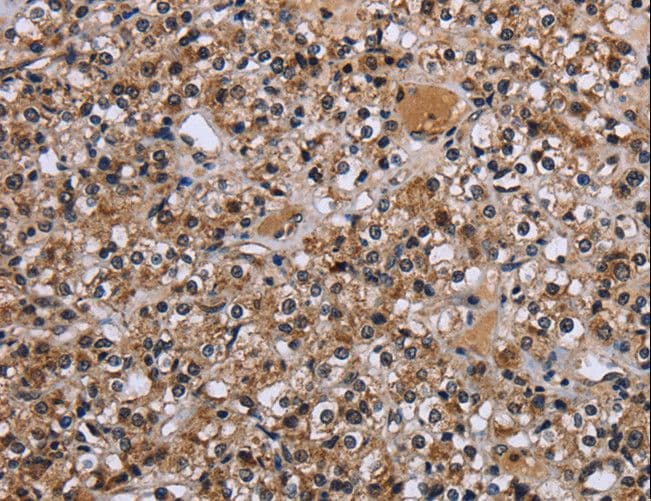 REL / C-Rel Antibody