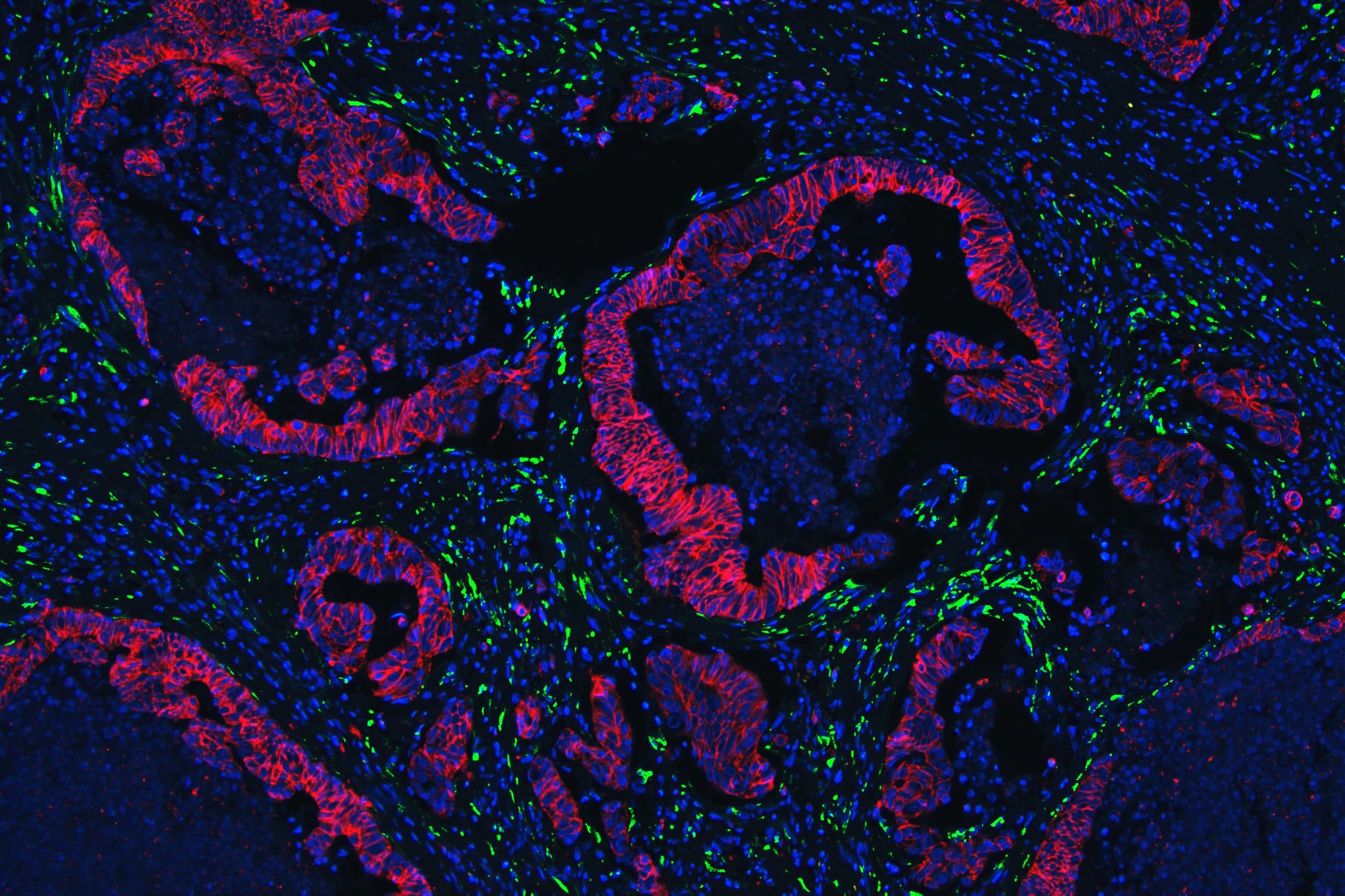 COL4A1 / Collagen IV Alpha1 Antibody (aa1445-1669)