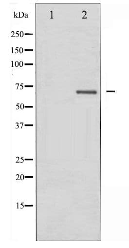 Polyclonal Rabbit anti-Human PIK3R1 / p85 Alpha Antibody (phospho-Tyr607, IHC, WB)