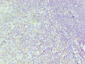 Polyclonal Rabbit anti-Human HNRNPD / AUF1 Antibody (aa1-306, IHC, WB)