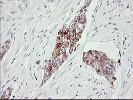 Monoclonal Mouse anti-Human RARRES1 Antibody (clone OTI1B1, IHC, WB)