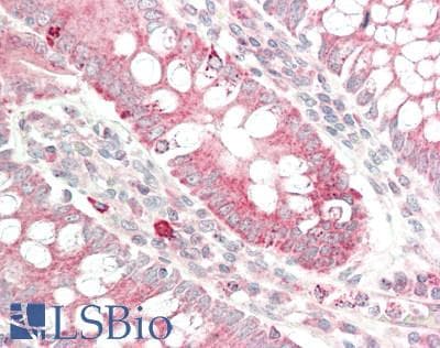 IHC-plus™ SCRIB / Scribble Antibody (aa382-410)