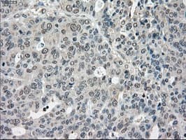 Monoclonal Mouse anti-Human CYPOR / POR Antibody (clone OTI3F10, IHC, IF, WB)