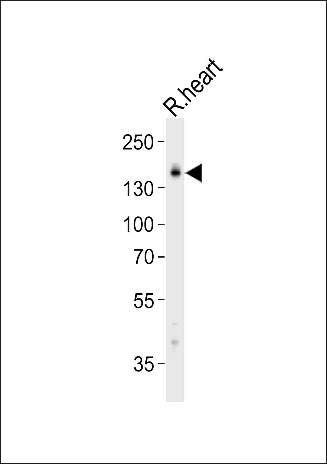 MYBPC3 / MYBP-C Antibody (aa189-218)